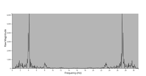  FFT of tremor analysis