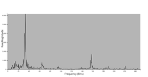 FFT-tremor-analysis