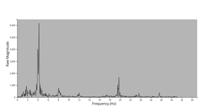 single sided of tremor analysis